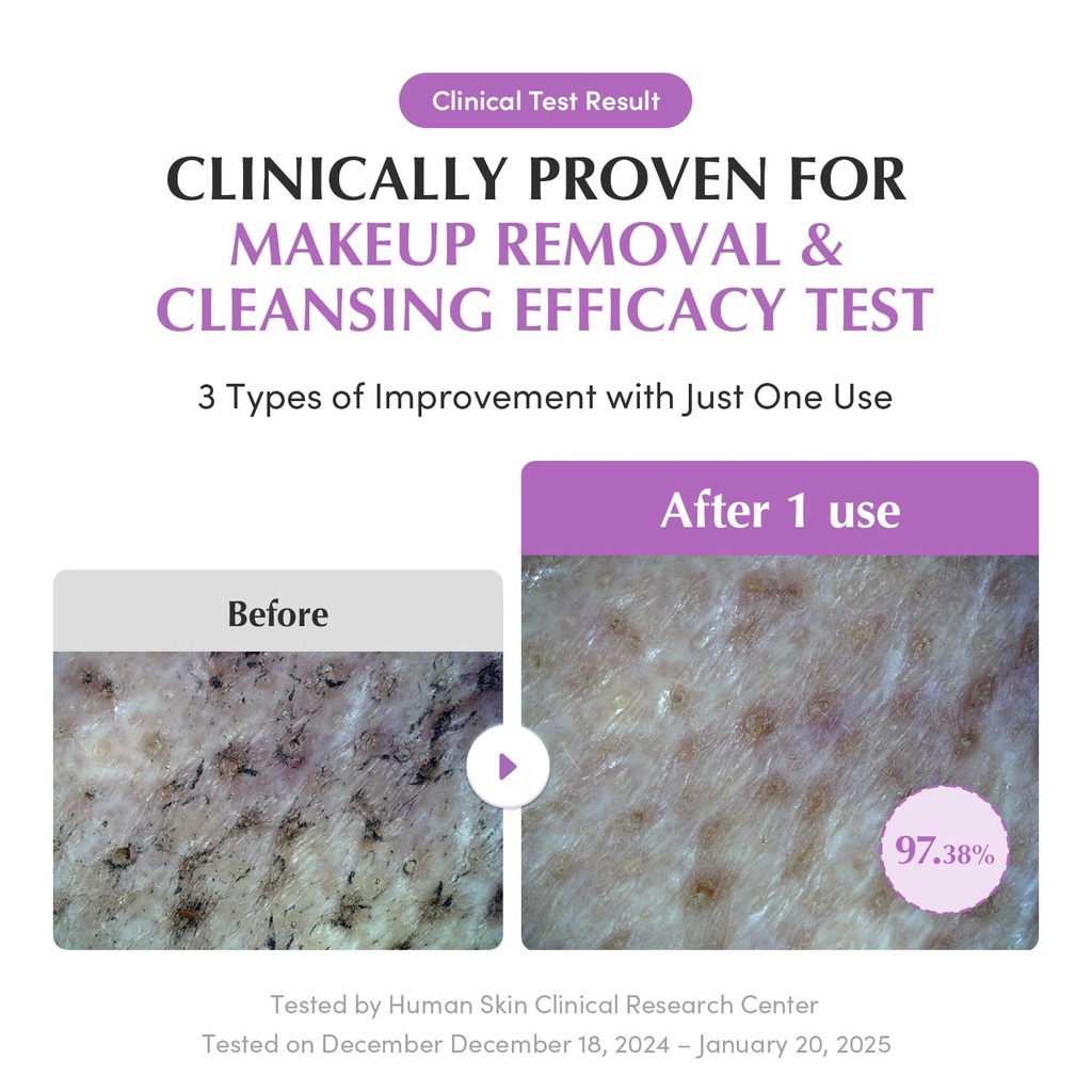 EQUALBERRY/ Purple Rice Pore Smoothing Cleansing Oil 200ml: ايكول بيري غسول زيتي بالارز البنفسجي لتقليل المسام