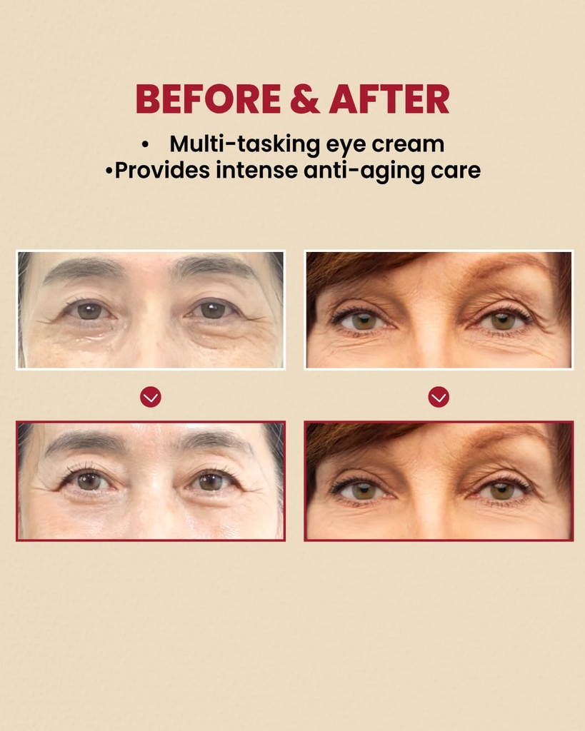 K-SECRET/ Seoul 1988 Eye Cream Retinal Liposome 4% 30ml: كي سيكرت كريم ريتينال لايبوسوم لتجاعيد وتصبغات العيون