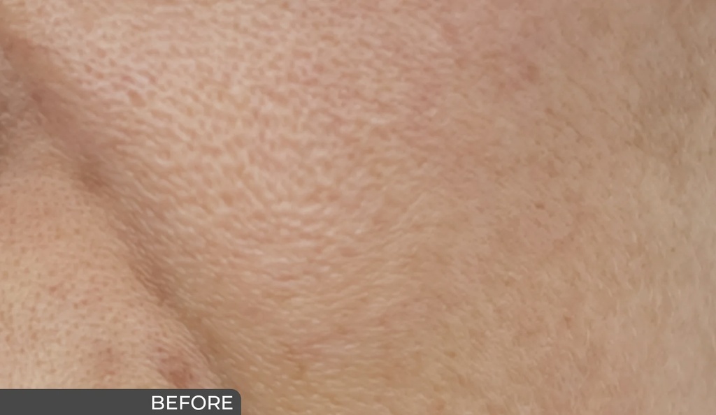 Ceuticoz/ IVORINE Cream Cleanser 100ml:سيتيكوز غسول كريمي لتنظيف البشرة بعمق وتوحيد لونها