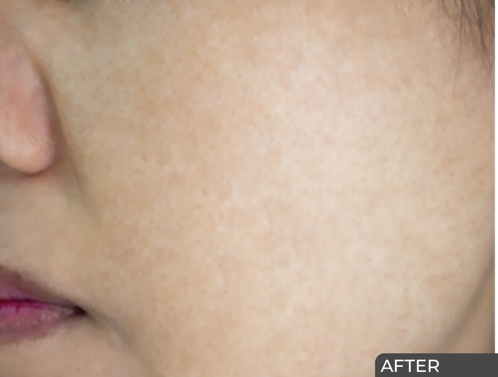 Ceuticoz/ Curalite Lightening Cream 50g: سيتيكوز كريم علاجي للتصبغات وتوحيد لون البشرة