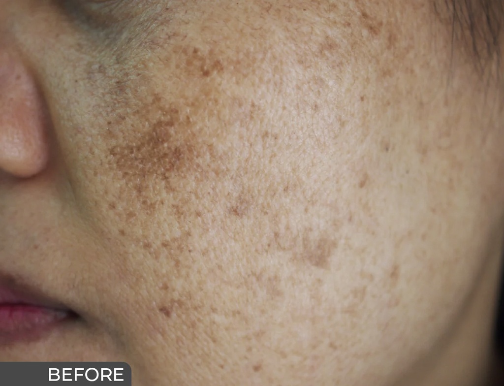 Ceuticoz/ Curalite Face Wash 75ml: سيتيكوز غسول الوجه المقشر