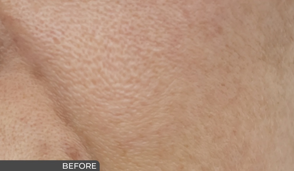 Ceuticoz/ IVORINE - Enzymatic Serum 30ml: سيتيكوز سيروم ايفورين انزيمي لتجديد البشرة