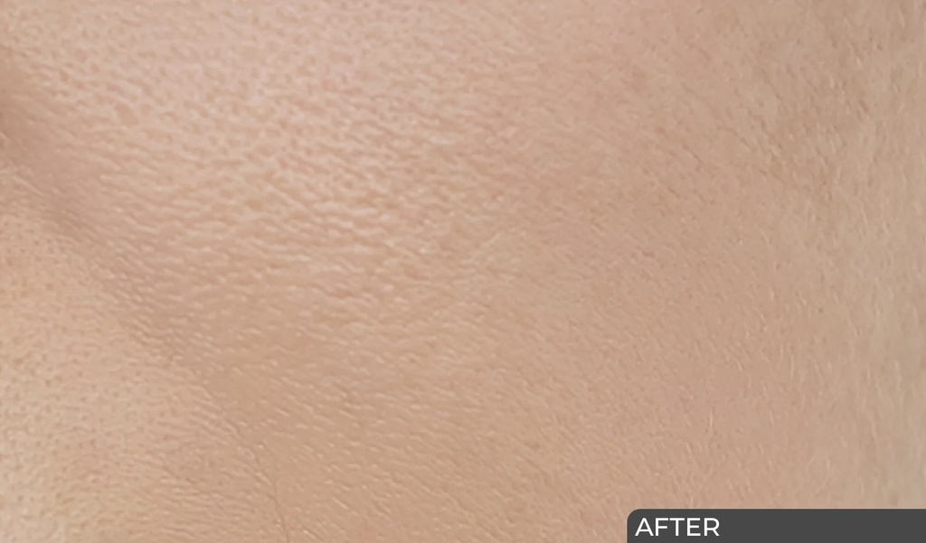 Ceuticoz/ IVORINE - Enzymatic Serum 30ml: سيتيكوز سيروم ايفورين انزيمي لتجديد البشرة