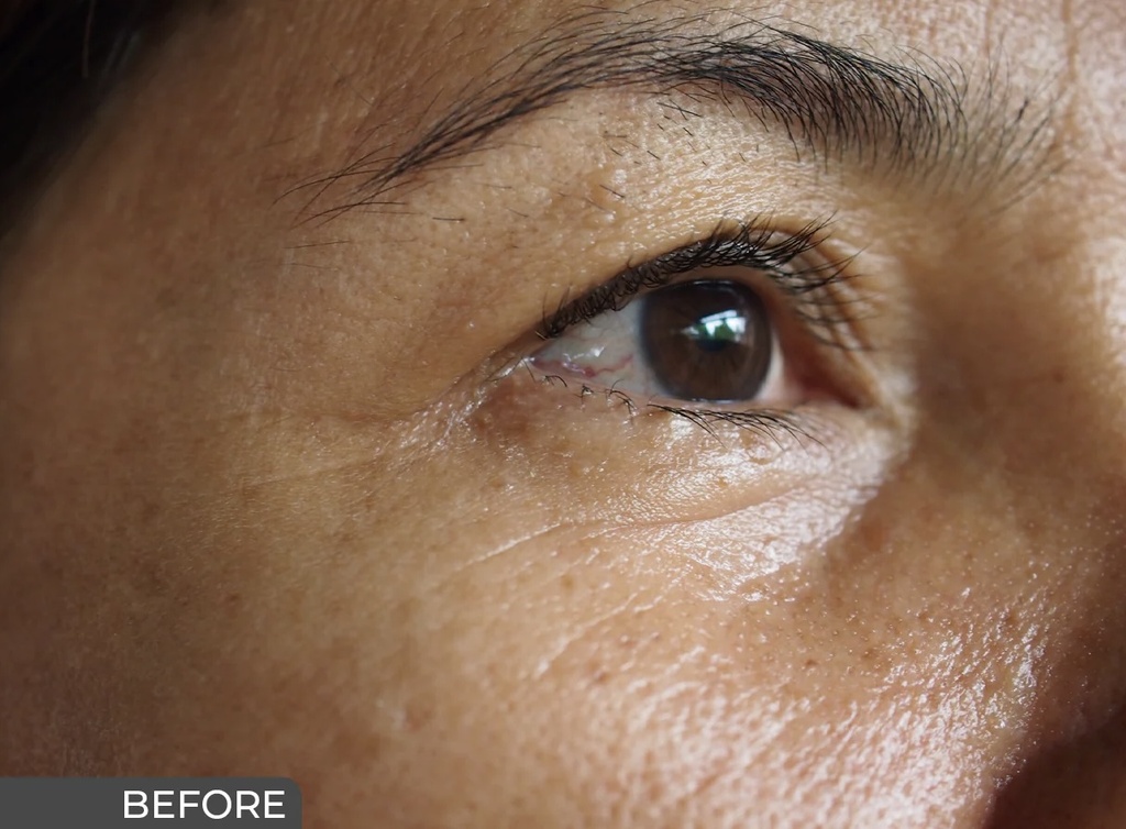 Ceuticoz/ MODUSEB - Oil Free Moisture 50g: سيتيكوز جل مرطب للبشرة الدهنية والمختلطة خالي من الزيوت