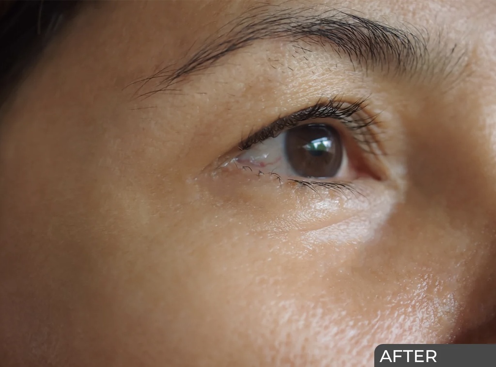 Ceuticoz/ MODUSEB - Oil Free Moisture 50g: سيتيكوز جل مرطب للبشرة الدهنية والمختلطة خالي من الزيوت