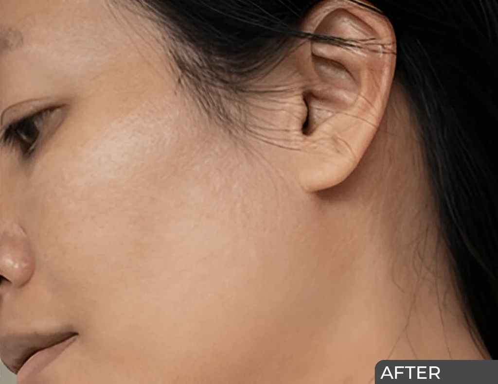 Ceuticoz/ UVICOZ IR - Dry Touch Sunscreen Gel 50g: سيتيكوز واقي شمس جل للبشرة الدهنية والمختلطة