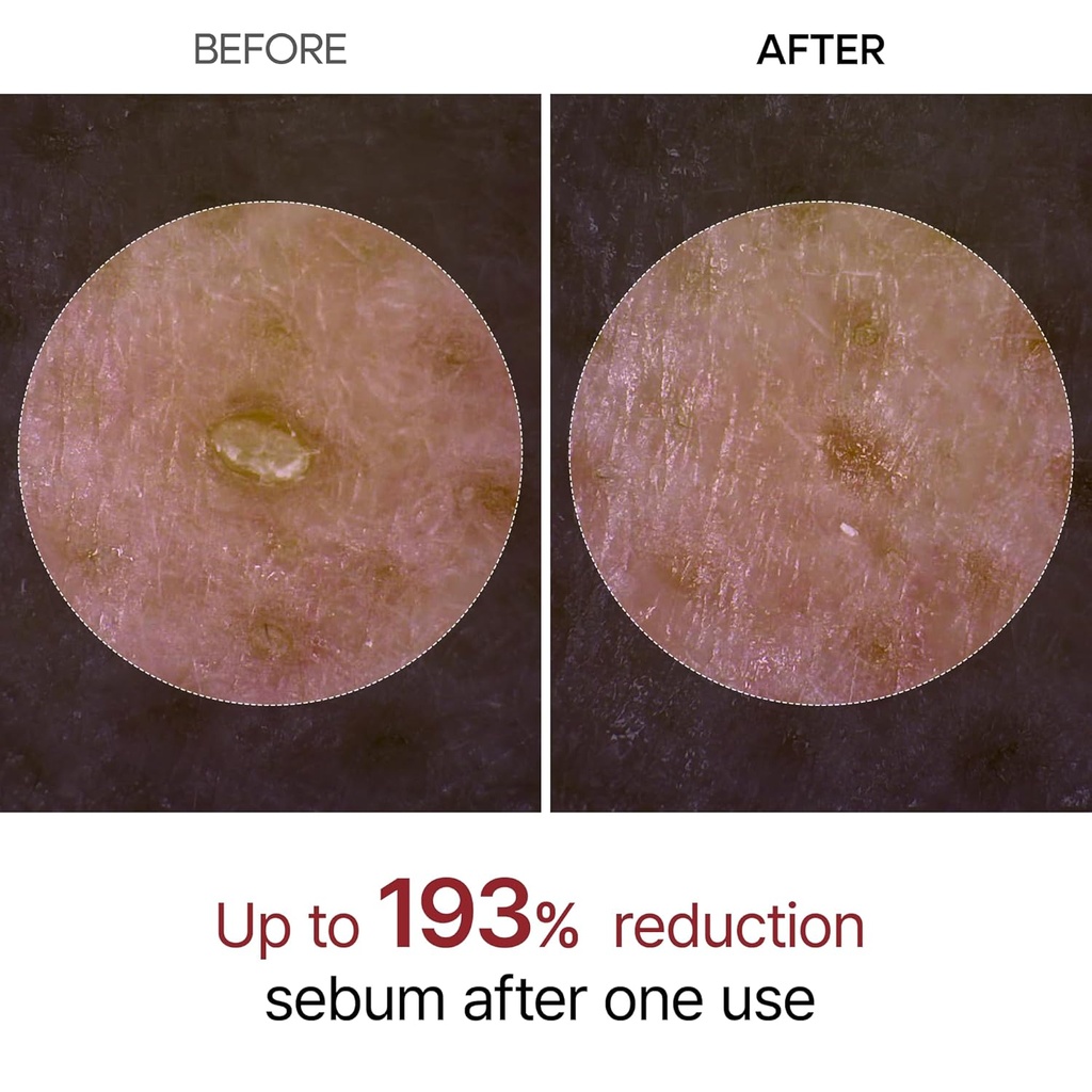 Dr Melaxin/ Peel Shot Glow Black Rice Peeling Ampoule for All Skin Types 80ml : امبول دكتور ميلاكسين بالارز الاسود للتقشير وازالة الرؤوس السوداء