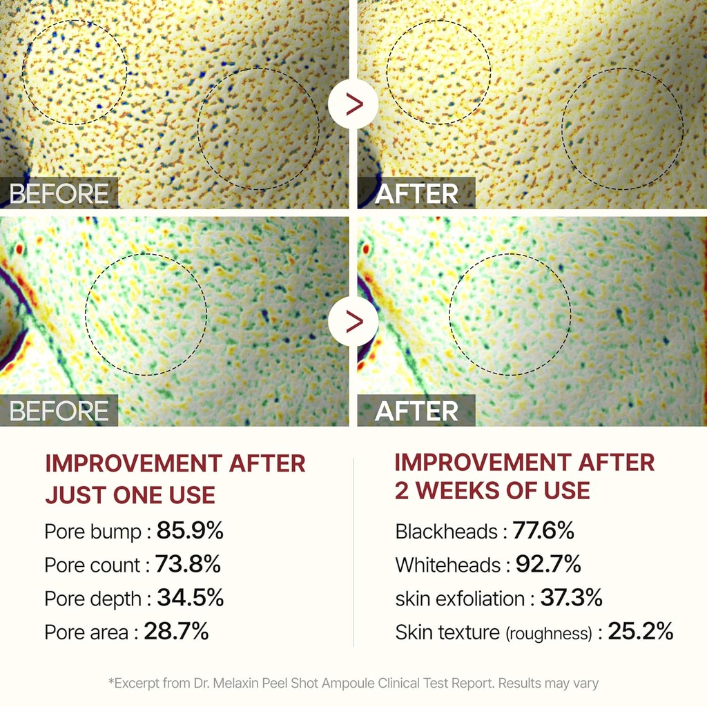 Dr Melaxin/ Peel Shot Glow Black Rice Peeling Ampoule for All Skin Types 80ml : امبول دكتور ميلاكسين بالارز الاسود للتقشير وازالة الرؤوس السوداء