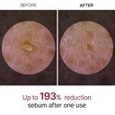 Dr Melaxin/ Peel Shot Glow White Rice Peeling Ampoule for All Skin Types 80ml : امبول دكتور ميلاكسين المقشّر بالارز الابيض لإزالة الرؤوس السوداء وتقليل المسام