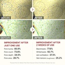 Dr Melaxin/ Peel Shot Glow White Rice Peeling Ampoule for All Skin Types 80ml : امبول دكتور ميلاكسين المقشّر بالارز الابيض لإزالة الرؤوس السوداء وتقليل المسام