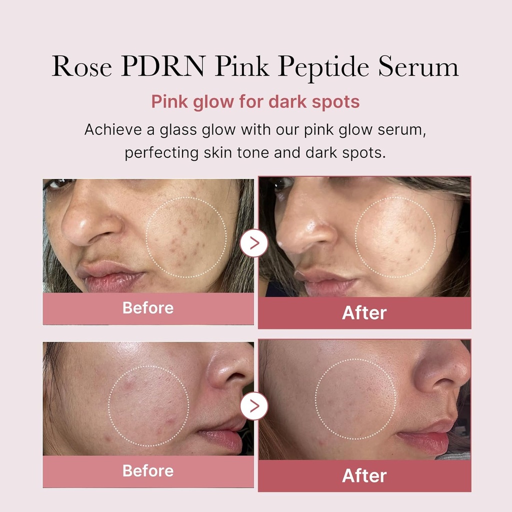 Medicube PDRN Pink Peptide Serum: