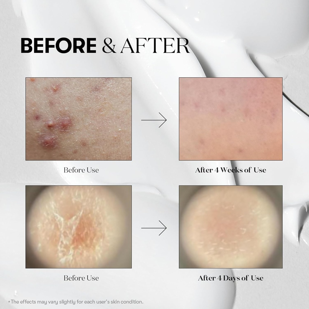 VT COSMETICS CICA + Hyalon Reedle Shot 100 Serum: سيروم سيكا وهيالون ريدل شوت