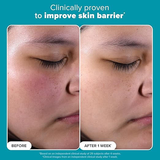 Paula's Choice/ SKIN PERFECTING 2% BHA Liquid Salicylic Acid: محلول السلسلك اسيد من باولا تشويس