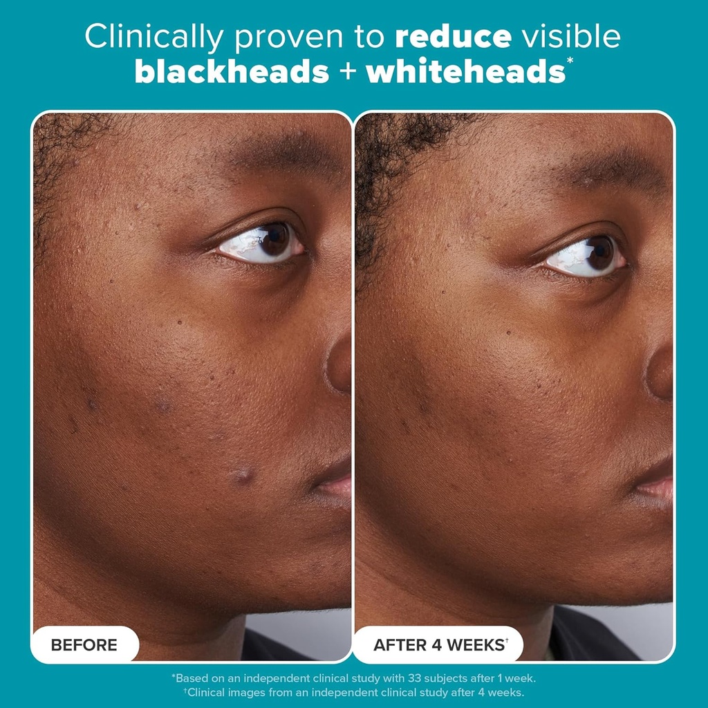 Paula's Choice/ SKIN PERFECTING 2% BHA Liquid Salicylic Acid: محلول السلسلك اسيد من باولا تشويس