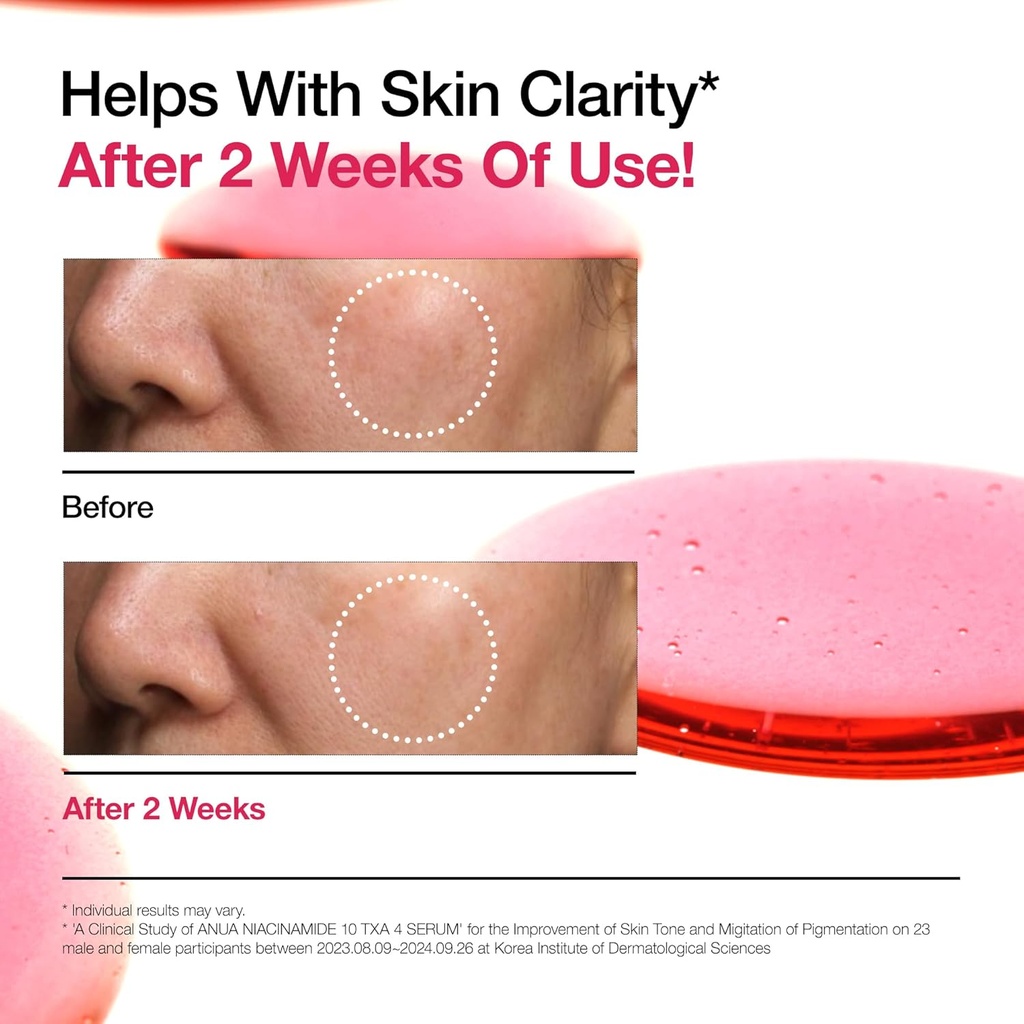 Anua Niacinamide10 + Txa 4 Serum 30ml/ سيروم انوا نياسنمايد تكسا