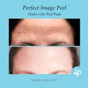Perfect Image/ Hydro-Glo Peeling Pads Tone 30 Pads: شرائح التقشير للتفتيح ومعالجة التصبغات من بيرفكت امج