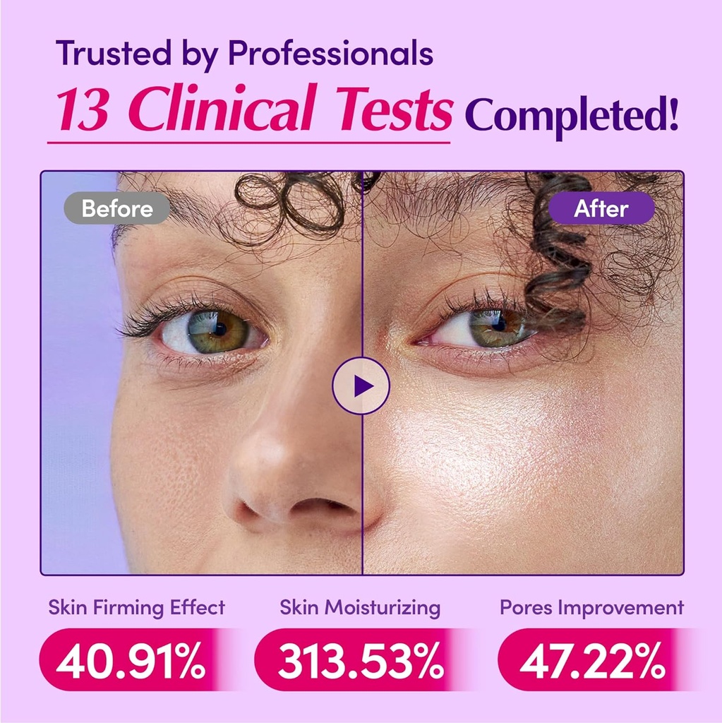 Equal Berry Serum 30ml: سيروم ايكول بيري للبشرة الحساسة