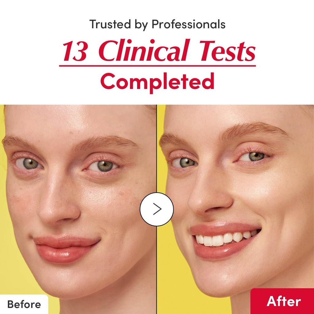 Equal Berry/ Vit. C Serum with Niacinamide 30m: ايكول بيري سيروم فيتامين سي لتعزيز وتفتيح البشرة