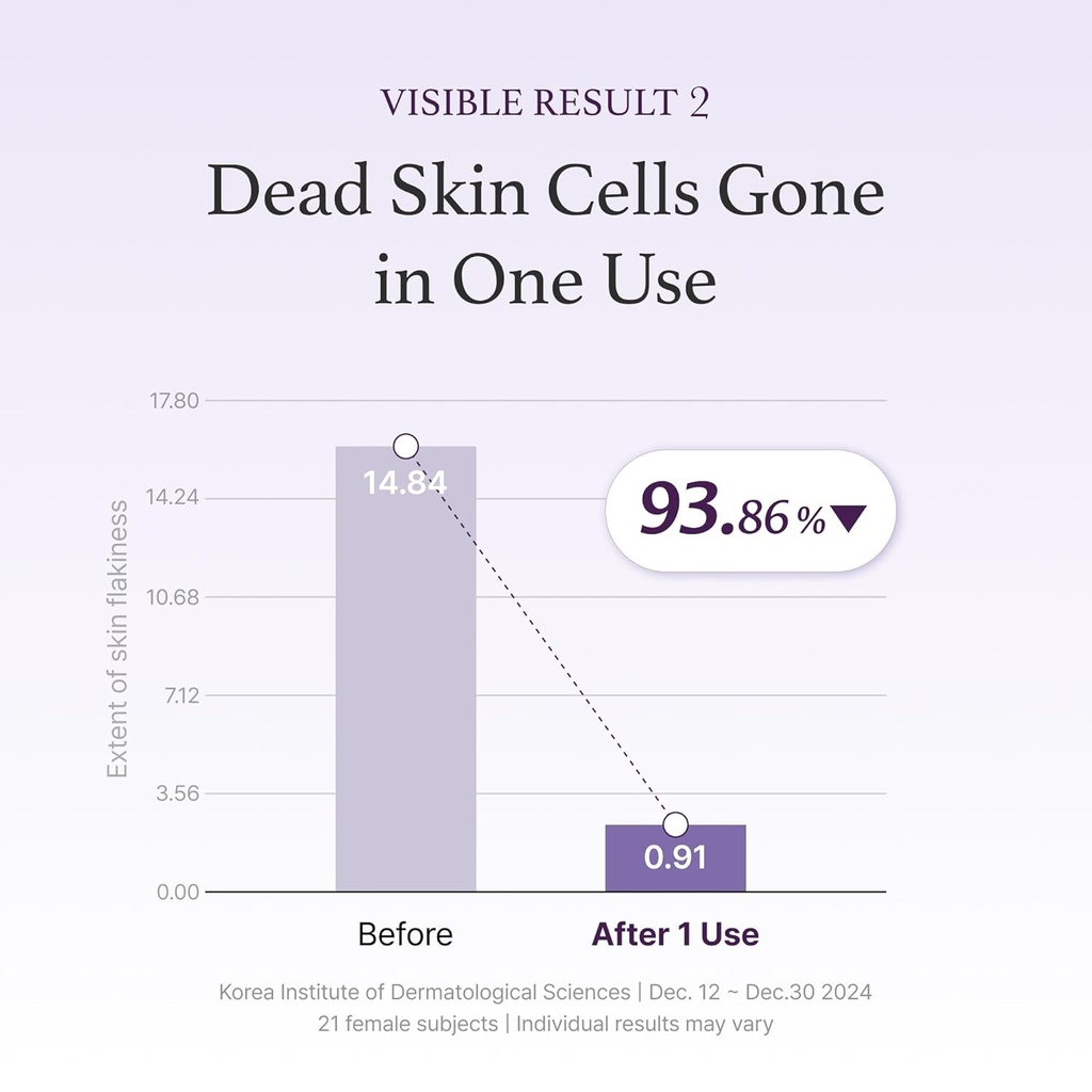 I'm from/ Black Rice Toner for Oily Skin: