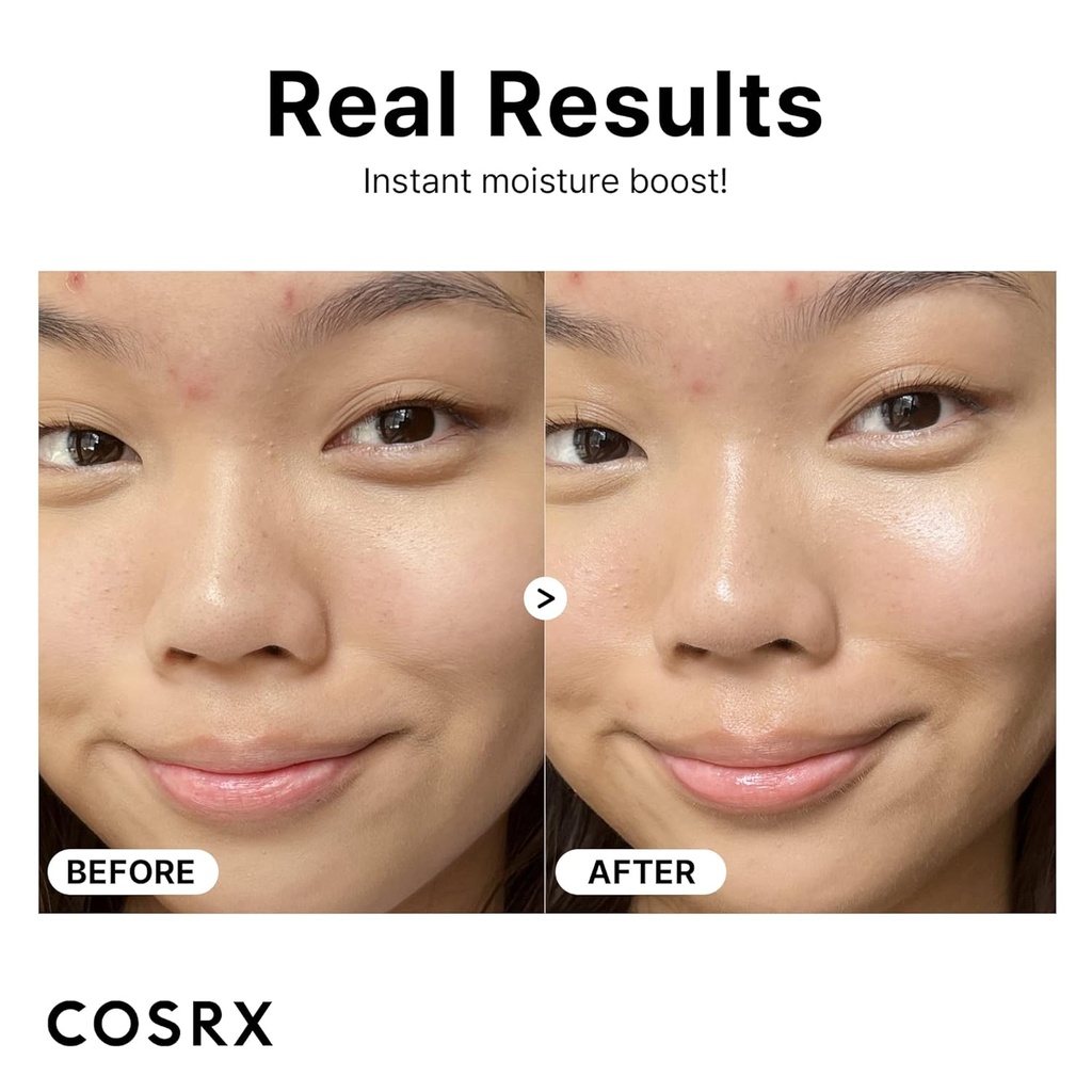COSRX/ Pure Sodium Hyaluronic Acid 3% Serum: